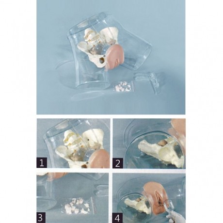 高级透明刮宫医学训练模型