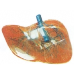 透明肝脏模型